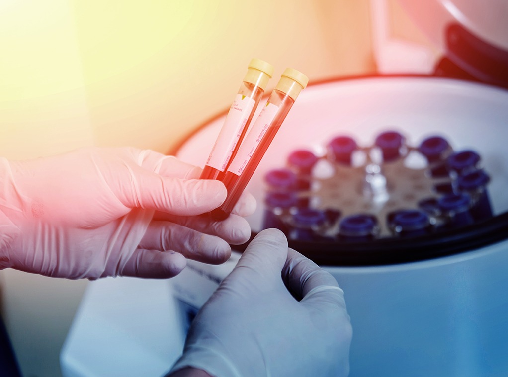Platelet-Rich plasma preparation. Tube with blood in hands. Centrifuge. Background; Shutterstock ID 617777972; purchase_order: Limited 4/1/24; job: ; client: ; other: